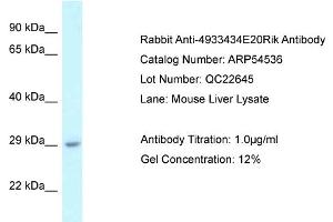 Western Blotting (WB) image for anti-RIKEN CDNA 4933434E20 Gene (4933434E20RIK) (N-Term) antibody (ABIN2774077) (4933434E20Rik 抗体  (N-Term))
