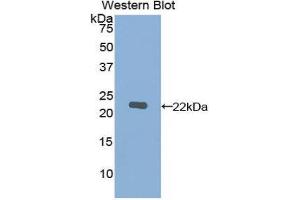 Western Blotting (WB) image for anti-Matrix Metallopeptidase 12 (Macrophage Elastase) (MMP12) (AA 290-469) antibody (ABIN1078306) (MMP12 抗体  (AA 290-469))