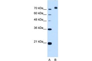 Western Blotting (WB) image for anti-Corin, Serine Peptidase (CORIN) antibody (ABIN2463005) (Corin 抗体)