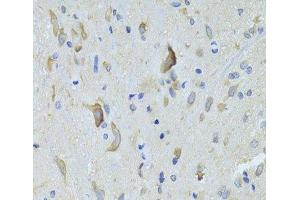 Immunohistochemistry of paraffin-embedded Rat spinal cord using SARS Polyclonal Antibody at dilution of 1:100 (40x lens). (Seryl-tRNA Synthetase (SARS) 抗体)