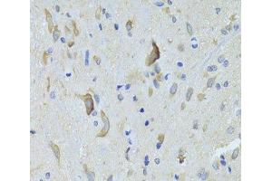 Immunohistochemistry of paraffin-embedded Rat spinal cord using SARS Polyclonal Antibody at dilution of 1:100 (40x lens). (Seryl-tRNA Synthetase (SARS) 抗体)