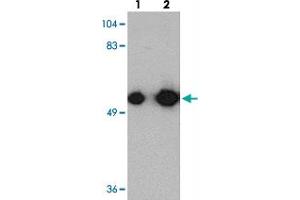 Western blot analysis of KREMEN1 in rat small intestine tissue with KREMEN1 polyclonal antibody  at (lane 1) 0. (KREMEN1 抗体  (C-Term))
