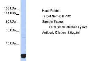 Host: Rabbit Target Name: ITPR2 Sample Type: Fetal Small Intestine lysates Antibody Dilution: 1.