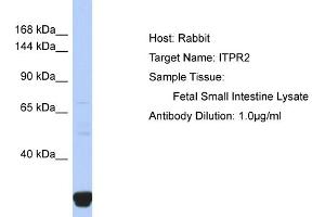 Host: Rabbit Target Name: ITPR2 Sample Type: Fetal Small Intestine lysates Antibody Dilution: 1. (ITPR2 抗体  (N-Term))