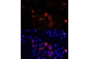 Immunofluorescence analysis of HeLa cells using MT-ND2 antibody (ABIN7268600) at dilution of 1:100.