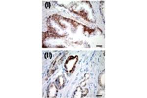 IHC for USP2a in a formalin-fixed, paraffin-embedded human prostate sample. (USP2 抗体  (N-Term))