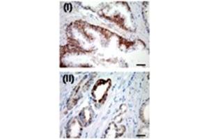 IHC for USP2a in a formalin-fixed, paraffin-embedded human prostate sample. (USP2 抗体  (N-Term))