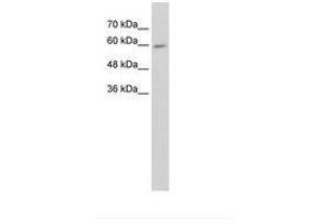 Image no. 1 for anti-Cytochrome P450, Family 4, Subfamily F, Polypeptide 11 (CYP4F11) (AA 51-100) antibody (ABIN203436)