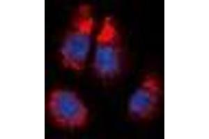 Immunofluorescent analysis of Alpha-1A Adrenergic Receptor staining in NIH3T3 cells. (alpha 1 Adrenergic Receptor 抗体  (C-Term))