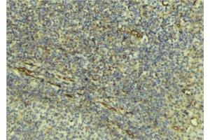 ABIN6276540 at 1/100 staining Human lymph tissue by IHC-P. (DcR1 抗体)