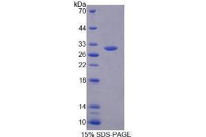 Image no. 1 for Mediator Complex Subunit 8 (MED8) (AA 25-268) protein (His tag) (ABIN6239669)