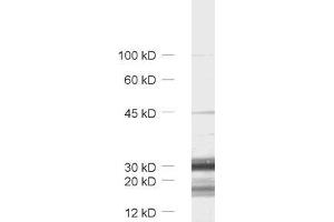 dilution: 1 : 1000, sample: synaptic vesicle fraction (LP2) of rat brain (TMEM163 抗体  (AA 44-63))