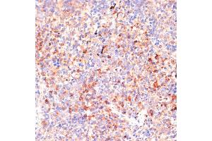 Immunohistochemistry of paraffin-embedded mouse spleen using IL4R antibody (ABIN7268001) at dilution of 1:100 (40x lens). (IL4 Receptor 抗体  (AA 26-232))