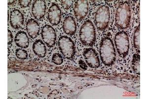 Immunohistochemistry (IHC) image for anti-Minichromosome Maintenance Complex Component 3 (MCM3) (Internal Region) antibody (ABIN6287318)