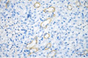 Immunohistochemistry was performed on paraffin-embedded mouse kidney using keratin 18 antibody (ABIN7799174), 1:200).
