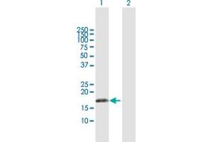 Western Blot analysis of IFNA17 expression in transfected 293T cell line by IFNA17 MaxPab polyclonal antibody. (IFNA17 抗体  (AA 1-189))