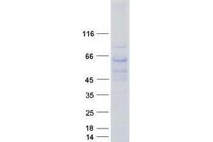 Western Blotting (WB) image for Transducin (Beta)-Like 1X-Linked (TBL1X) (Transcript Variant 1) protein (Myc-DYKDDDDK Tag) (ABIN2733297)