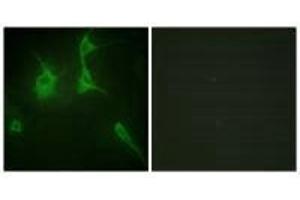 Immunofluorescence analysis of NIH/3T3 cells, using Collagen IX α3 antibody. (COL9A3 抗体)