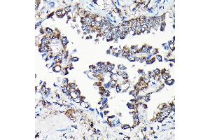 Immunohistochemistry (IHC) image for anti-Ubiquitin Specific Peptidase 5 (USP5) (AA 1-280) antibody (ABIN1683231)
