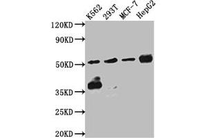 Western Blot Positive WB detected in: K562 whole cell lysate, 293T whole cell lysate, MCF-7 whole cell lysate, HepG2 whole cell lysate All lanes: Chk1 antibody at 1:1000 Secondary Goat polyclonal to rabbit IgG at 1/50000 dilution Predicted band size: 55, 44, 51 kDa Observed band size: 55 kDa
