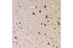 Immunohistochemical analysis of DDX3X (pT322) staining in human brain formalin fixed paraffin embedded tissue section. (DDX3X 抗体  (pSer322))