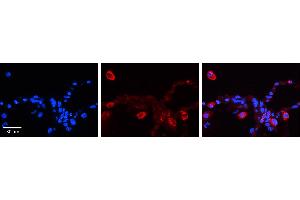 PCDHGC4 antibody - N-terminal region          Formalin Fixed Paraffin Embedded Tissue:  Human Lung Tissue    Observed Staining:  Cytoplasm of pneumocytes   Primary Antibody Concentration:  1:100    Secondary Antibody:  Donkey anti-Rabbit-Cy3    Secondary Antibody Concentration:  1:200    Magnification:  20X    Exposure Time:  0. (PCDHGC4 抗体  (N-Term))