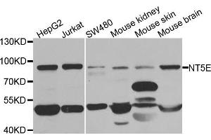 Western blot analysis of extracts of various cell lines, using NT5E antibody (ABIN5971061) at 1/1000 dilution. (CD73 抗体)