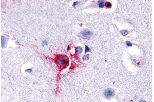 Anti-Delta Opioid Receptor antibody  ABIN1048495 IHC staining of human brain, neurons and glia. (OPRD1 抗体  (N-Term))
