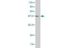 Western Blot detection against Immunogen (36. (FOXD1 抗体  (AA 1-91))