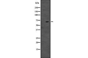 Western blot analysis of CENPT expression in ; HepG2 cell lysate,The lane on the left is treated with the antigen-specific peptide. (CENPT 抗体  (Internal Region))