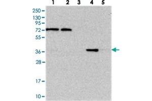 Western blot analysis of Lane 1: RT-4, Lane 2: U-251 MG, Lane 3: Human Plasma, Lane 4: Liver, Lane 5: Tonsil with C11orf54 polyclonal antibody . (C11orf54 抗体)
