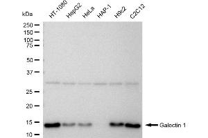 Western blotting analysis using Galectin 1 antibody (ABIN7799243). (Recombinant LGALS1/Galectin 1 抗体)