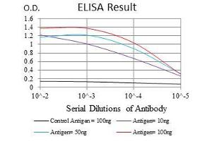 Black line: Control Antigen (100 ng), Purple line: Antigen(10 ng), Blue line: Antigen (50 ng), Red line: Antigen (100 ng), (TNNI2 抗体)
