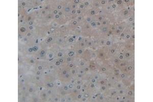 IHC-P analysis of Human Tissue, with DAB staining. (VRK1 抗体  (AA 46-292))