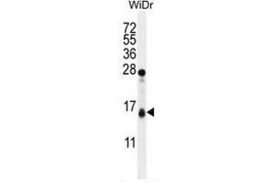 TOMM20L Antibody (N-term) western blot analysis in WiDr cell line lysates (35 µg/lane). (TOMM20L 抗体  (N-Term))