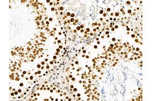 ABIN6265482 and ABIN6269020 at 1/100 staining Rat testis tissue by IHC-P. (TBP 抗体  (N-Term))
