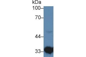 Detection of HADH in Human Liver lysate using Polyclonal Antibody to Hydroxyacyl Coenzyme A Dehydrogenase (HADH)