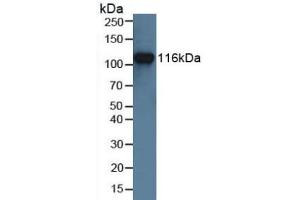 Detection of MUSK in Human Jurkat Cells using Polyclonal Antibody to Muscle, Skeletal, Receptor Tyrosine Kinase (MUSK) (MUSK 抗体  (AA 517-777))
