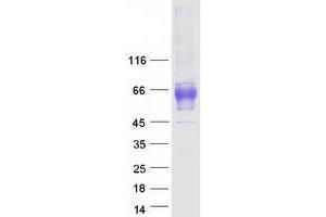 Validation with Western Blot
