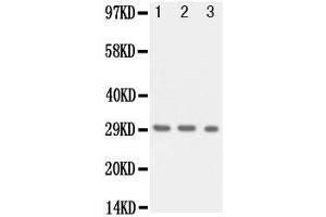 Anti-Kallikrein 1 antibody, Western blotting Lane 1: Recombinant Human KLK1 Protein 10ng Lane 2: Recombinant Human KLK1 Protein 5ng Lane 3: Recombinant Human KLK1 Protein 2.