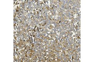IHC analysis of ASAH1 using anti-ASAH1 antibody (ABIN7602206). (ASAH1 抗体  (AA 63-393))