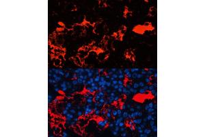 Immunofluorescence analysis of human liver cancer cells using Albumin antibody (ABIN3021924, ABIN3021925, ABIN3021926, ABIN1512560 and ABIN6217701) at dilution of 1:100. (Albumin 抗体)