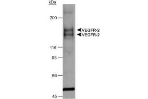 Image no. 2 for anti-Fms-Related tyrosine Kinase 1 (VEGFR1) (FLT1) (AA 800-900), (Internal Region) antibody (ABIN363475) (FLT1 抗体  (Internal Region))