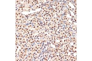 Immunohistochemistry (IHC) image for anti-Acidic (Leucine-Rich) Nuclear phosphoprotein 32 Family, Member B (ANP32B) antibody (ABIN7265377)