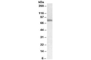 Western blot testing of human pancreas cancer lysate with TGM2 antibody at 0. (Transglutaminase 2 抗体)