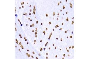 Immunohistochemistry (Paraffin-embedded Sections) (IHC (p)) image for anti-Histone 3 (H3) (H3K9me3) antibody (ABIN3016030)