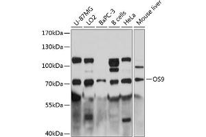 Western blot analysis of extracts of various cell lines, using OS9 antibody (ABIN6131415, ABIN6145063, ABIN6145064 and ABIN6215868) at 1:3000 dilution. (OS9 抗体  (AA 353-612))