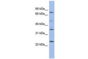 Image no. 1 for anti-Protein Phosphatase, Mg2+/Mn2+ Dependent, 1K (PPM1K) (C-Term) antibody (ABIN6743697) (PPM1K 抗体  (C-Term))