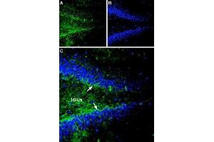Expression of Gephyrin in rat hippocampus - Immunohistochemical staining of rat hippocampal dentate gyrus sections using Anti-Gephyrin Antibody (ABIN7043214, ABIN7044520 and ABIN7044521). (Gephyrin 抗体  (Intracellular))