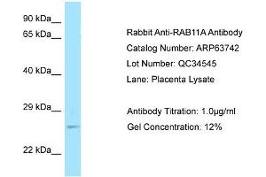 Western Blotting (WB) image for anti-RAB11A, Member RAS Oncogene Family (RAB11A) (C-Term) antibody (ABIN2789607) (RAB11A 抗体  (C-Term))